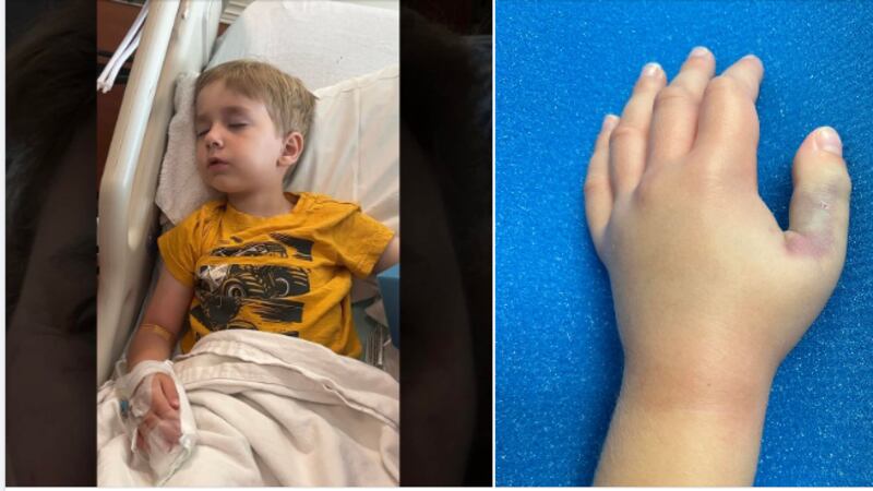 Un niño de 5 años fue mordido por una serpiente cabeza de cobre en Texas